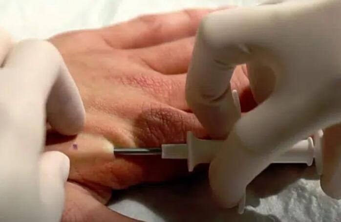NFC Implant Tag.jpg NFC Implant Tag.jpg